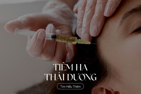 Tiêm xoá nhăn thái dương